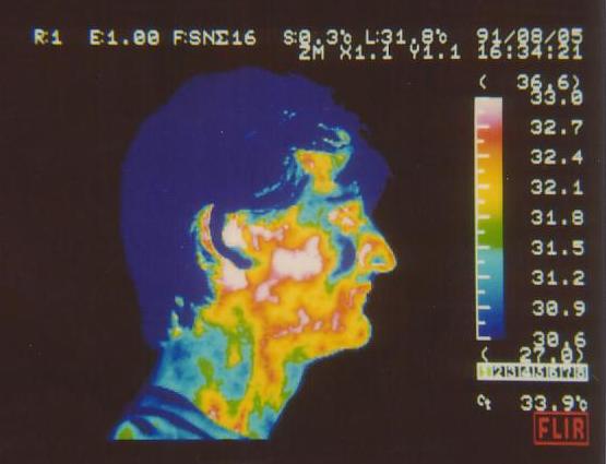 Infrared thermal image, 1991